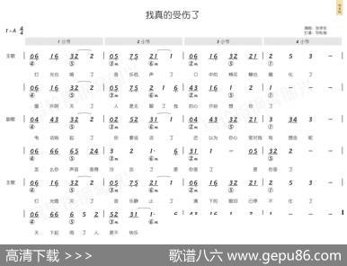 我真的受伤了（简和谱） - 王菀之|王菀之